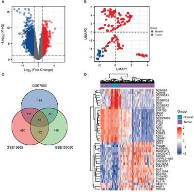 Decreased expression of SCARA5 predicts a poor prognosis in melanoma using bioinformatics analysis